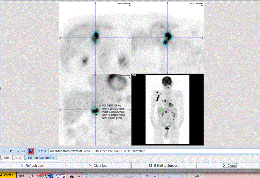 Onco_LesionDocumentation(2)