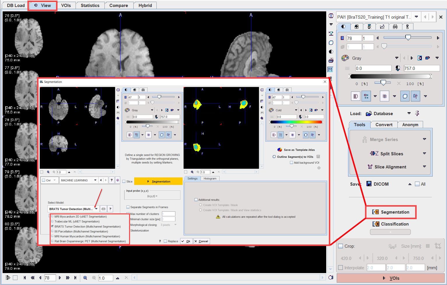 VIEW_ML_Interface