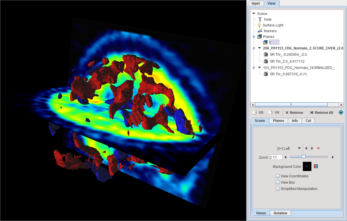 3D Rendering BrainDB