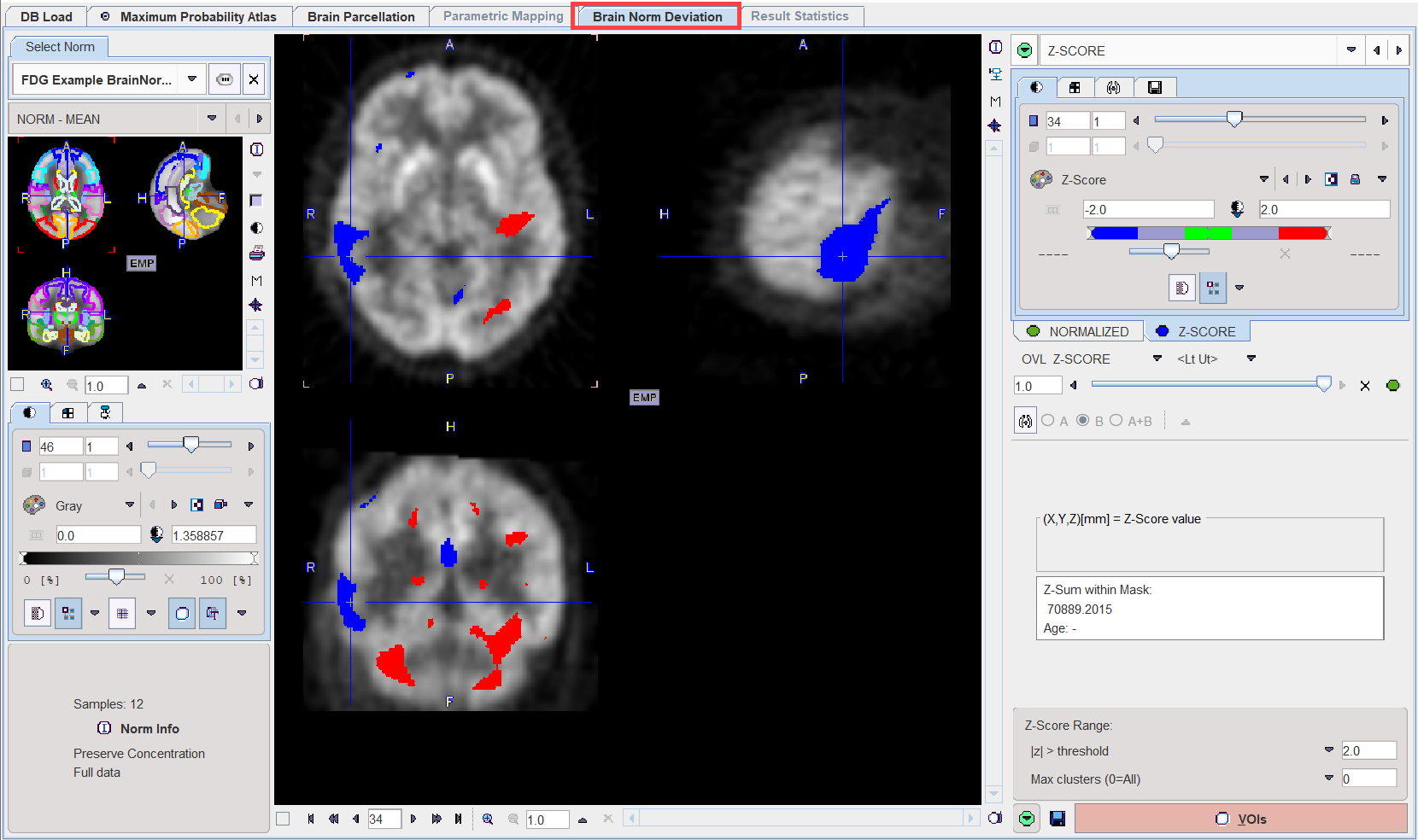 C2NPFUS1Example