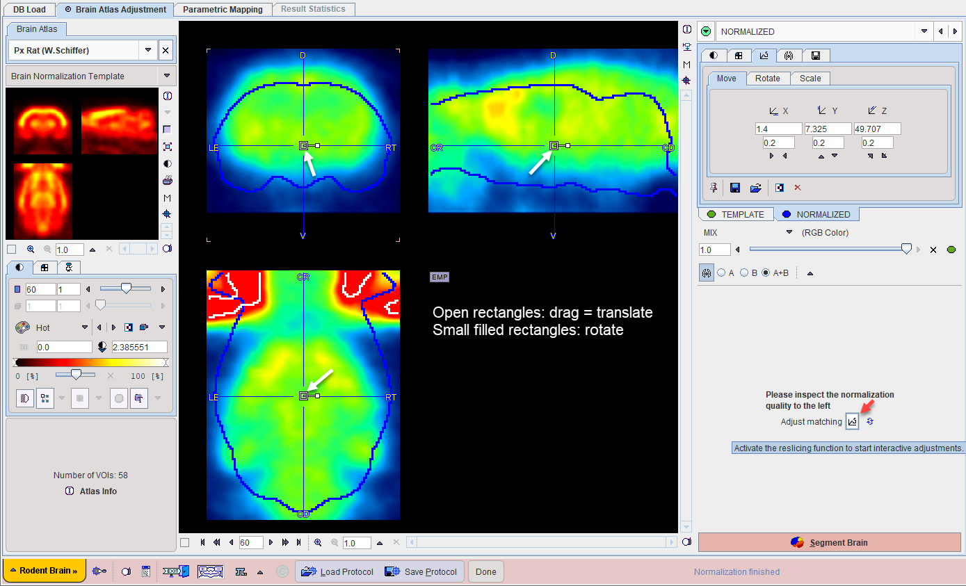 SingleModalityManualNormalization